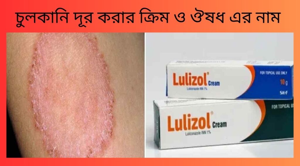 চুলকানি দূর করার ক্রিম ও ঔষধ এর নাম