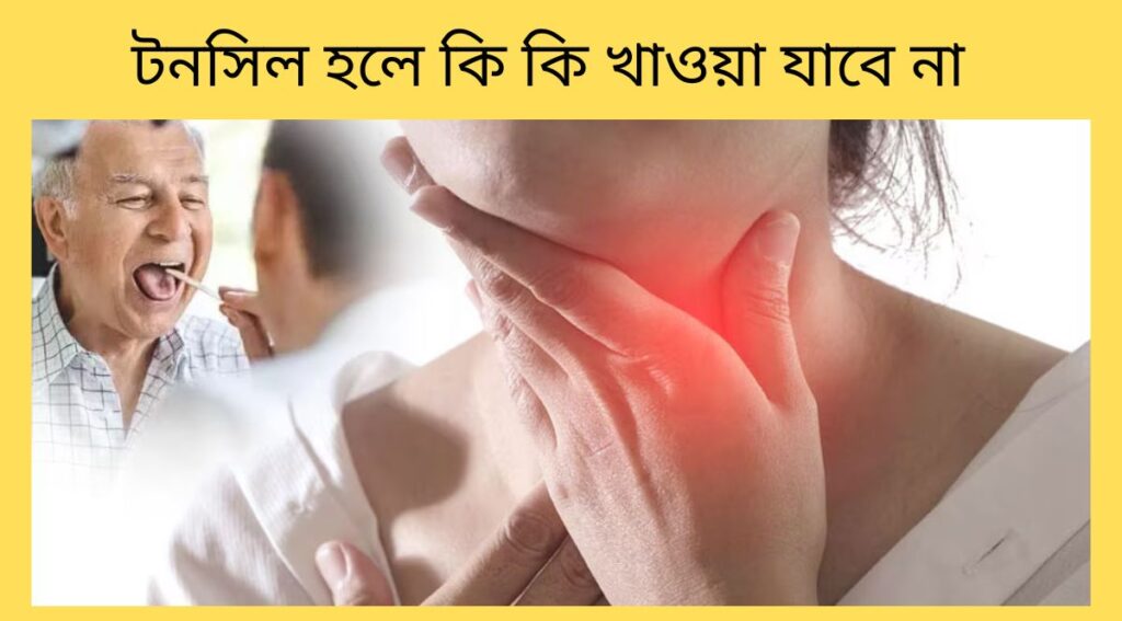 টনসিল হলে কি কি খাওয়া যাবে না